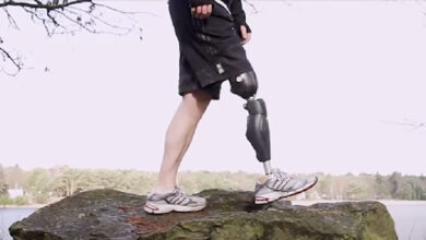 Bionic Legs and Feet Standing on a rock