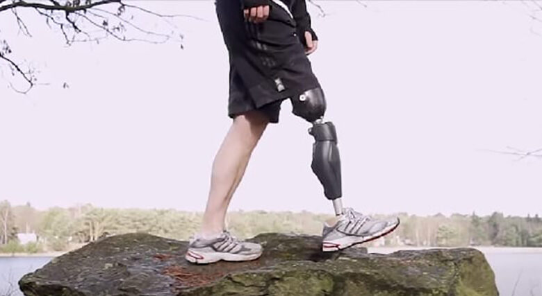 Bionic Legs and Feet Standing on a rock