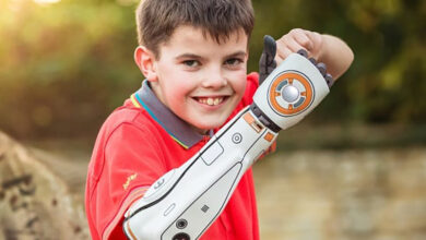 Child with a white bionic arm