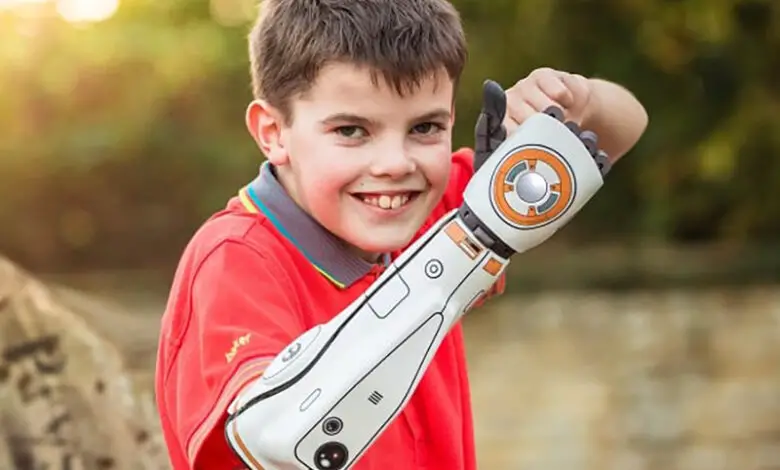 Child with a white bionic arm