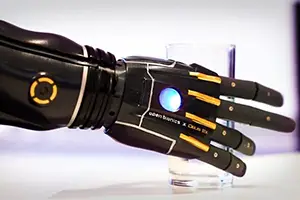 most advanced prosthetic arm 2022