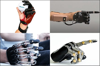 Partial Hand Prosthesis Four Options