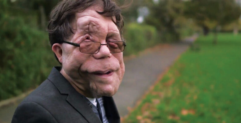 Adam Pearson Says Actors with Disabilities Are Typecast